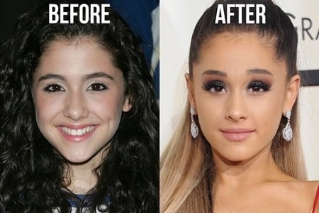 A picture of Ariana Grande's nose before and after.